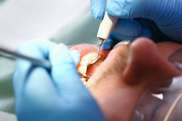 Best Emergency Treatment for Toothache in University Park, MD