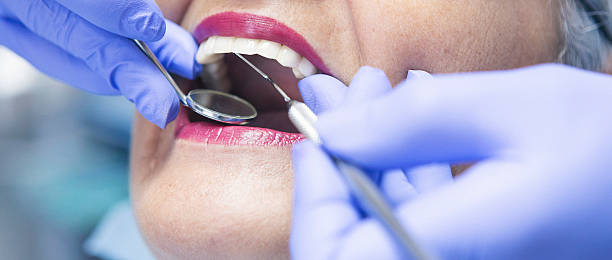 Best Emergency Wisdom Teeth Removal in University Park, MD